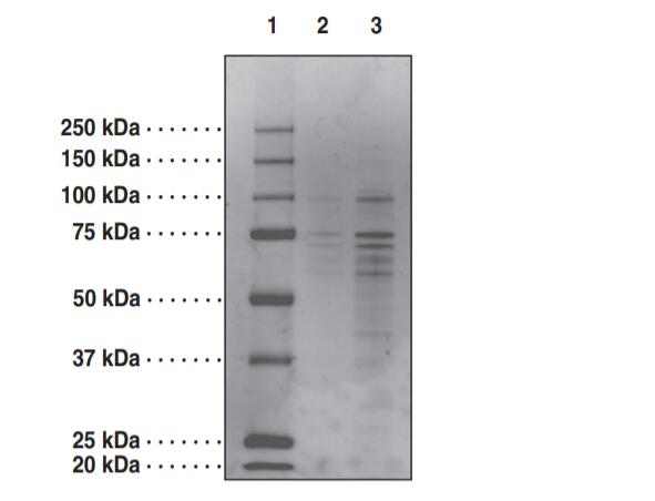 Lane 1: MW Markers; Lane 2: COX1 (2 μg); Lane 3: COX1 (5 μg).